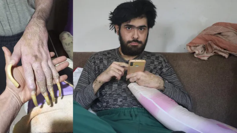 Akıllara durgunluk veren olay! Cep telefonu yüzünden 3 yıldır evden dışarı adım atmadı